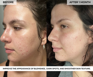 BEAUTY POPS™ Glow Enzyme Frozen Mask Kit