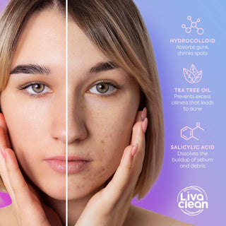 Bright Blossoms Pimple Patches